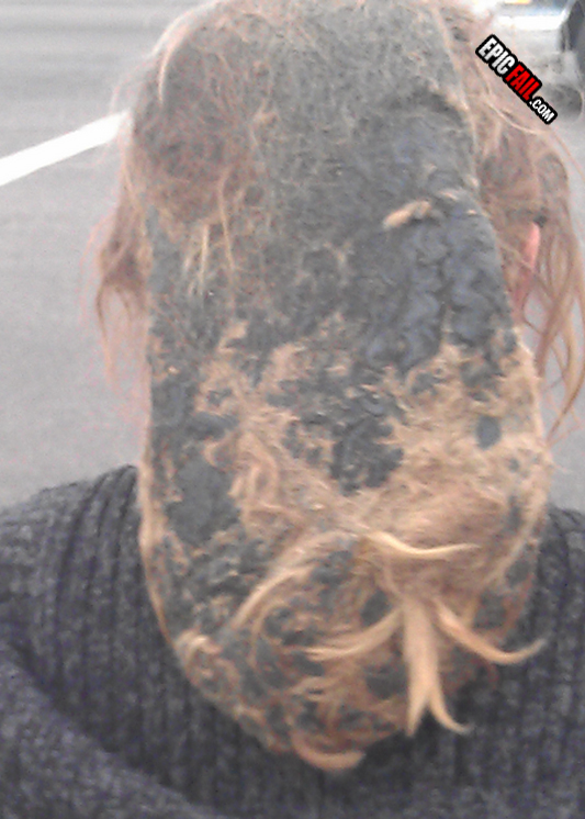 Watch: dreadlocks Fail