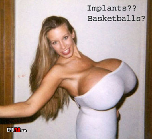 Watch: epic Boob Job Fail